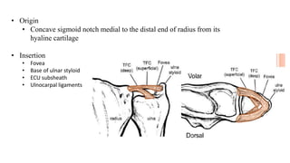 • Origin
• Concave sigmoid notch medial to the distal end of radius from its
hyaline cartilage
• Insertion
• Fovea
• Base of ulnar styloid
• ECU subsheath
• Ulnocarpal ligaments
 