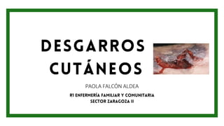 DESGARROS
CUTÁNEOS
PAOLA FALCÓN ALDEA
R1 ENFERMERÍA FAMILIAR Y COMUNITARIA
SECTOR ZARAGOZA II
 