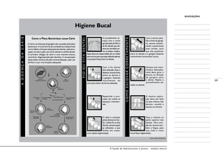 A Saúde de Adolescentes e Jovens - módulo básico
69
anotações
-
Como a Placa Bacteriana causa Cárie
A cárie e as doenças da gengiva são causadas pela placa
bacteriana. A única forma de combatê-las é adquirindo
como hábito a limpeza adequada dos dentes, pela esco-
vação correta e pelo uso do fio dental ou da fita dental.
O primeiro estágio da cárie é uma mancha branca,
reversível, diagnosticada pelo dentista. A recuperação
dessa lesão inicial se dá pela remineralização, pelo uso
de flúor e por uma limpeza adequada.
ADOENÇADACÁRIE
Higiene Bucal
COMOESCOVARCORRETAMENTE
FIOOUFITADENTAL
O procedimento co-
meça com o corte
aproximadode40cm
de fio dental que de-
verá ser enrolado en-
tre os dedos médios.
Após deve ser desenrolado de um dedo
paraoutrosparaquesejautilizadaapenas
a sua parte limpa entre os dentes.
Com o fio dental
bemesticado,faça-o
deslizar suavemente
entre os dentes e
a gengiva, fazendo
movimentos de
cima para baixo de forma delicada.
Repetindo o pro-
cesso em todos os
espaços interden-
tais.
O ideal é começar
pelos dentes do fun-
do. Utilize fio ou fita
dental, sempre após
as refeições, o que
facilita, em, muito,
uma rápida higienização.
Com a escova para-
lela à linha da gengi-
va, escove pressio-
nando suavemente
suas cerdas, para
que elas penetrem
entre os dentes e a gengiva fazendo
movimentos horizontais curtos.
Sempre com movi-
mentos delicados,
você deve girar a
escova na direção
da gengiva para
o dente. Repita o
procedimento em
todos os dentes.
A mesma opera-
ção deve ser feita
na face interna dos
dentes, usando a
escova na vertical.
Faça o mesmo na
parte superior dos
dentes. Para com-
ple-tar, escove tam-
bém a língua, para
que todo o meio
bucal fique higienizado.
Consumo
freqüente de açúcar
Placa
bacteriana
Placa
cariogênica
Má higiene
bucal
Desmineralização
do dente
Remineralização
do dente
Boa higiene bucal
+
uso racional do flúor
Tratamento
restaurador
Lesões
irreversíveis
Dentes
restaurados
Tratamento da
doença cárie
Lesões
reversíveis
(manchas brancas)
Dentes
intactos
Mancha
branca
Fonte: Johnson  Johnson.
 