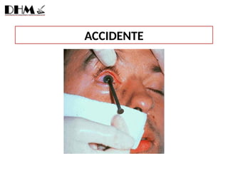 ACCIDENTE
 