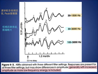 ABR_Stimulus Recording Patient factors influencing ABR_(I).ppt