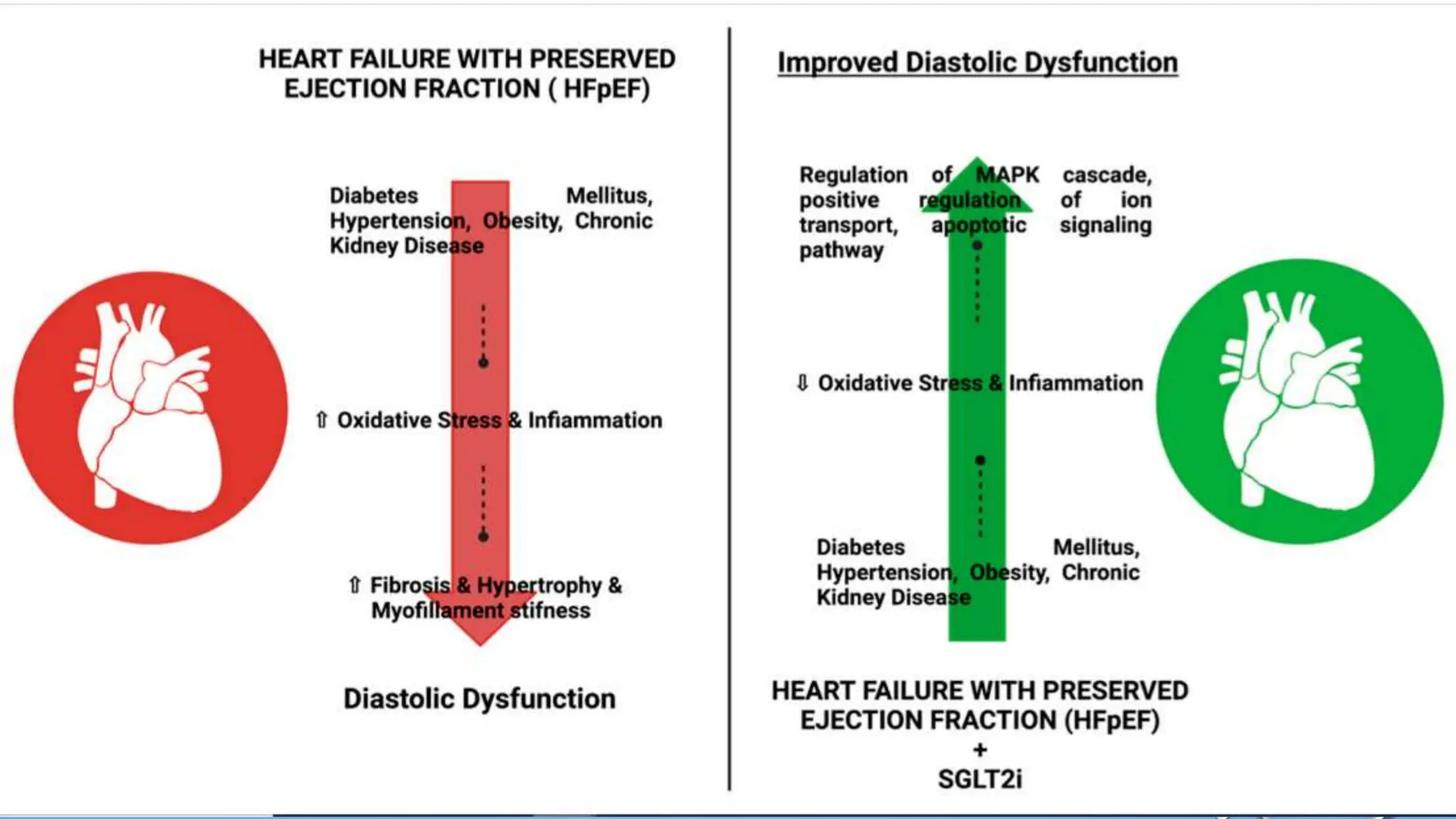 2023 ACC Expert Consensus heart failure hfref