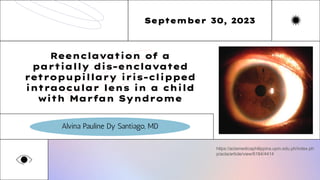 September 30, 2023
Reenclavation of a
partially dis-enclavated
retropupillary iris-clipped
intraocular lens in a child
with Marfan Syndrome
Alvina Pauline Dy Santiago, MD
https://actamedicaphilippina.upm.edu.ph/index.ph
p/acta/article/view/6184/4414
 