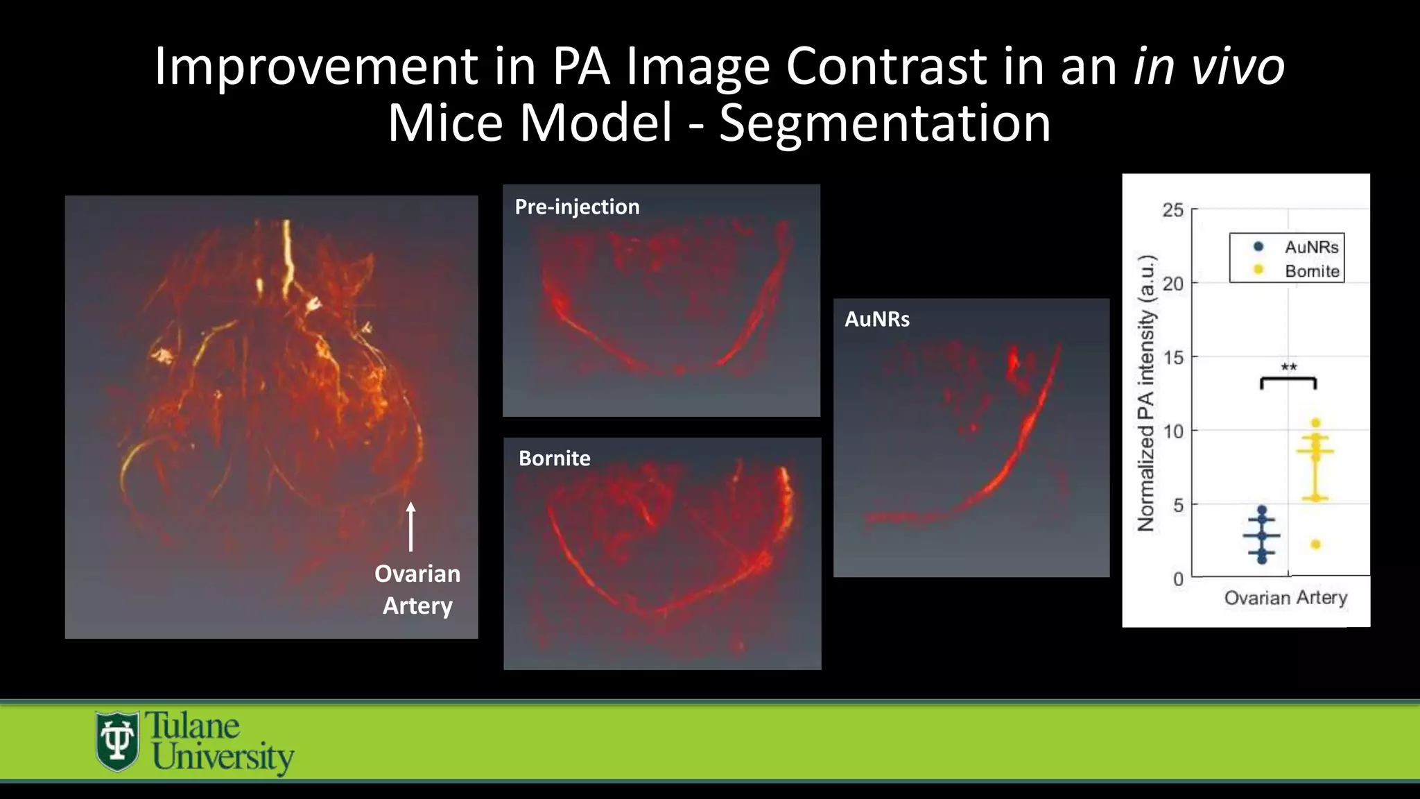 Ovarian
Artery
Pre-injection
Bornite
AuNRs
Improvement in PA Image Contrast in an in vivo
Mice Model - Segmentation
 