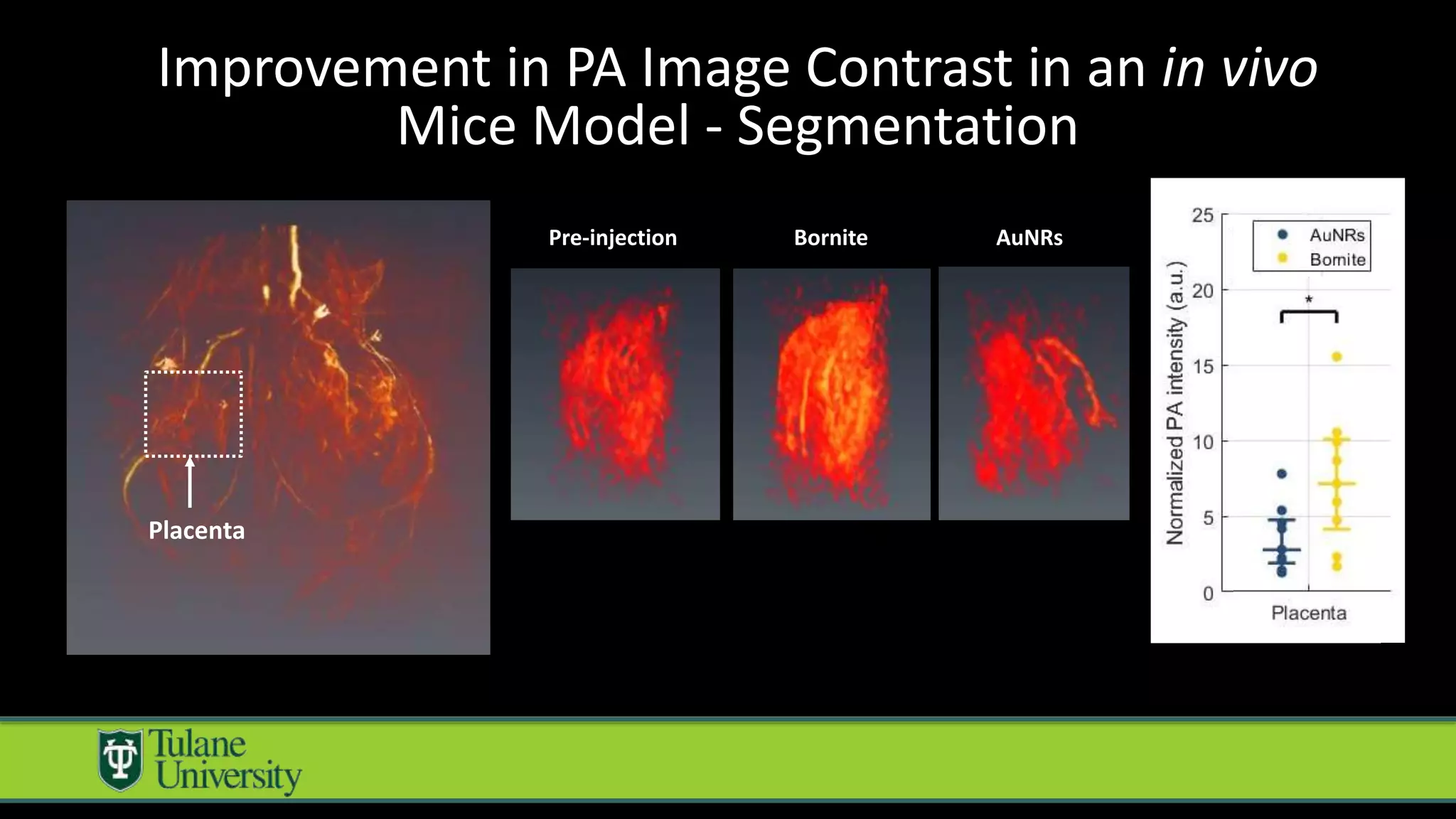 Placenta
Pre-injection Bornite AuNRs
Improvement in PA Image Contrast in an in vivo
Mice Model - Segmentation
 