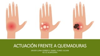 ACTUACIÓN FRENTE A QUEMADURAS
JAVIER LUNA FERRER E ISABEL FUNES JULIAN
R2 CS ALMOZARA
 