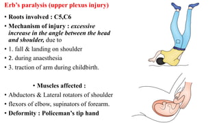 Fall Plexus Event 2024— DETAILED ANATOMY OF BRACHIAL PLEXUS. Pdf | PDF