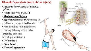 Fall Plexus Event 2024— DETAILED ANATOMY OF BRACHIAL PLEXUS. Pdf | PDF