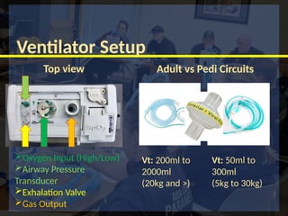 Adult vs Pedi Circuits
Top view
Ventilator Setup
Vt: 200ml to
2000ml
(20kg and >)
Vt: 50ml to
300ml
(5kg to 30kg)
Oxygen Input (High/Low)
Airway Pressure
Transducer
Exhalation Valve
Gas Output
 