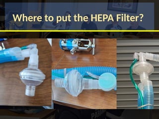 Where to put the HEPA Filter?
 