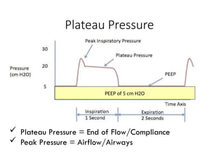 ZOLL Medical
Plateau Pressure
 Plateau Pressure = End of Flow/Compliance
 Peak Pressure = Airflow/Airways
PEEP of 5 cm H2O
 
