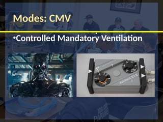 Modes: CMV
•Controlled Mandatory Ventilation
•
 