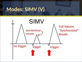 Modes: SIMV (V)
trigger
Full Volume
“Synchronized”
Breath
 