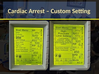 Cardiac Arrest – Custom Setting
 