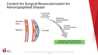 2024 Lower Extremity Peripheral Artery Disease Guideline Clinical ...