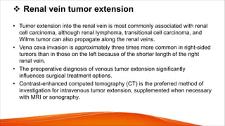 v Renal vein tumor extension
• Tumor extension into the renal vein is most commonly associated with renal
cell carcinoma, although renal lymphoma, transitional cell carcinoma, and
Wilms tumor can also propagate along the renal veins.
• Vena cava invasion is approximately three times more common in right-sided
tumors than in those on the left because of the shorter length of the right
renal vein.
• The preoperative diagnosis of venous tumor extension significantly
influences surgical treatment options.
• Contrast-enhanced computed tomography (CT) is the preferred method of
investigation for intravenous tumor extension, supplemented when necessary
with MRI or sonography.
 