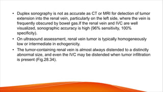 • Duplex sonography is not as accurate as CT or MRI for detection of tumor
extension into the renal vein, particularly on the left side, where the vein is
frequently obscured by bowel gas.If the renal vein and IVC are well
visualized, sonographic accuracy is high (96% sensitivity, 100%
specificity).
• On ultrasound assessment, renal vein tumor is typically homogeneously
low or intermediate in echogenicity.
• The tumor-containing renal vein is almost always distended to a distinctly
abnormal size, and even the IVC may be distended when tumor infiltration
is present (Fig.28.34).
 