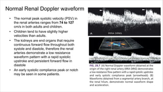 Normal Renal Doppler waveform
• The normal peak systolic velocity (PSV) in
the renal arteries ranges from 74 to 127
cm/s in both adults and children.
• Children tend to have slightly higher
velocities than adults.
• The kidneys are end organs that require
continuous forward flow throughout both
systole and diastole, therefore the renal
arteries demonstrate a low resistance
waveform pattern with a rapid systolic
upstroke and persistent forward flow in
diastole
• An early systolic compliance peak or notch
may be seen in some patients.
 