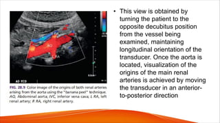 • This view is obtained by
turning the patient to the
opposite decubitus position
from the vessel being
examined, maintaining
longitudinal orientation of the
transducer. Once the aorta is
located, visualization of the
origins of the main renal
arteries is achieved by moving
the transducer in an anterior-
to-posterior direction
 