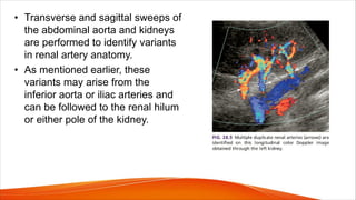 • Transverse and sagittal sweeps of
the abdominal aorta and kidneys
are performed to identify variants
in renal artery anatomy.
• As mentioned earlier, these
variants may arise from the
inferior aorta or iliac arteries and
can be followed to the renal hilum
or either pole of the kidney.
 