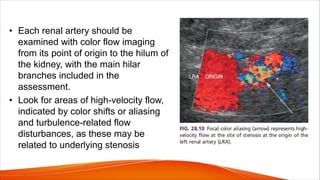 • Each renal artery should be
examined with color flow imaging
from its point of origin to the hilum of
the kidney, with the main hilar
branches included in the
assessment.
• Look for areas of high-velocity flow,
indicated by color shifts or aliasing
and turbulence-related flow
disturbances, as these may be
related to underlying stenosis
 