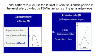 Renal aortic ratio (RAR) is the ratio of PSV in the stenotic portion of
the renal artery divided by PSV in the aorta at the renal artery level
 