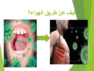‫الهواء؟‬ ‫طريق‬ ‫عن‬ ‫كيف‬
 