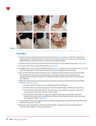 11 BLS
A
D
B
E
C
F
– Basic Life Support
CPR STEPS
1. Check for the carotid pulse on the side of the neck (Figure 4a). Keep in mind not to waste time
trying to feel for a pulse; feel for no more than 10 seconds. If you are not sure you feel a pulse,
begin CPR with a cycle of 30 chest compressions and two breaths.
2. Use the heel of one hand on the lower half of the sternum in the middle of the chest (Figure 4b).
3. Put your other hand on top of the first hand (Figure 4c).
4. Straighten your arms and press straight down (Figure 4c). Compressions should be 2 to 2.4” (5 to 6
cm) into the person’s chest and at a rate of 100 to 120 compressions per minute.
5. Be sure that between each compression you completely stop pressing on the chest and allow
the chest wall to return to its natural position. Leaning or resting on the chest between
compressions can keep the heart from refilling in between each compression and make CPR
less effective.
6. After 30 compressions, stop compressions and open the airway by tilting the head and lifting
the chin (Figure 4d & 4e).
a. Put your hand on the person’s forehead and tilt the head back.
b. Lift the person’s jaw by placing your index and middle fingers on the lower jaw; lift up.
c. Do not perform the head-tilt/chin-lift maneuver if you suspect the person may have a
neck injury. In that case, the jaw-thrust is used.
d. For the jaw-thrust maneuver, grasp the angles of the lower jaw and lift it with both
hands, one on each side, moving the jaw forward. If their lips are closed, open the lower
lip using your thumb (Figure 4f).
7. Give a breath while watching the chest rise. Repeat while giving a second breath. Breaths should
be delivered over one second.
8. Resume chest compressions. Switch quickly between compressions and rescue breaths to
minimize interruptions in chest compressions.
Figure 4
 