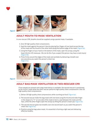 13
ADULT MOUTH-TO-MASK VENTILATION
In one-rescuer CPR, breaths should be supplied using a pocket mask, if available.
ADULT BAG-MASK VENTILATION IN TWO-RESCUER CPR
BLS
A
A
B
B
C
C
– Basic Life Support
Figure 6
Figure 5
1. Give 30 high-quality chest compressions.
2. Seal the mask against the person’s face by placing four fingers of one hand across the top
of the mask and the thumb of the other hand along the bottom edge of the mask (Figure 5a).
3. Using the fingers of your hand on the bottom of the mask, open the airway using the
head-tilt/chin-lift maneuver. (Do not do this if you suspect the person may have a neck injury)
(Figure 5b).
4. Press firmly around the edges of the mask and ventilate by delivering a breath over
one second as you watch the person’s chest rise
(Figure 5c).
If two people are present and a bag-mask device is available, the second rescuer is positioned
at the victim’s head while the other rescuer performs high-quality chest compressions. Give 30
high-quality chest compressions.
1. Deliver 30 high-quality chest compressions while counting out loud (Figure 6a).
2. The second rescuer holds the bag-mask with one hand using the thumb and index finger
in the shape of a “C” on one side of the mask to form a seal between the mask and the
face, while the other fingers open the airway by lifting the person’s lower jaw (Figure 6b).
3.
4. Practice using the bag-valve-mask; it is essential to forming a tight seal and delivering
effective breaths.
The second rescuer gives two breaths over one second each as you watch the person’s
chest rise (Figure 6c).
 