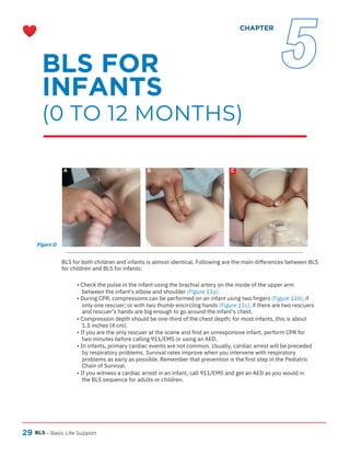 29 BLS
A B C
– Basic Life Support
BLS for both children and infants is almost identical. Following are the main differences between BLS
for children and BLS for infants:
• Check the pulse in the infant using the brachial artery on the inside of the upper arm
between the infant’s elbow and shoulder (Figure 11a).
• During CPR, compressions can be performed on an infant using two fingers (Figure 11b), if
only one rescuer; or with two thumb-encircling hands (Figure 11c), if there are two rescuers
and rescuer’s hands are big enough to go around the infant’s chest.
• Compression depth should be one-third of the chest depth; for most infants, this is about
1.5 inches (4 cm).
• If you are the only rescuer at the scene and find an unresponsive infant, perform CPR for
two minutes before calling 911/EMS or using an AED.
• In infants, primary cardiac events are not common. Usually, cardiac arrest will be preceded
by respiratory problems. Survival rates improve when you intervene with respiratory
problems as early as possible. Remember that prevention is the first step in the Pediatric
Chain of Survival.
• If you witness a cardiac arrest in an infant, call 911/EMS and get an AED as you would in
the BLS sequence for adults or children.
Figure 11
BLS FOR
INFANTS
(0 TO 12 MONTHS)
CHAPTER
5
 