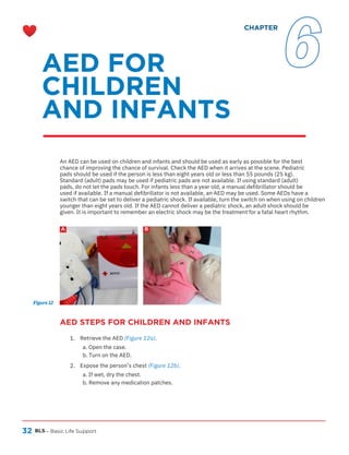 32
AED STEPS FOR CHILDREN AND INFANTS
BLS
A B
– Basic Life Support
1.
2.
Retrieve the AED (Figure 12a).
a. Open the case.
b. Turn on the AED.
Expose the person’s chest (Figure 12b).
a. If wet, dry the chest.
b. Remove any medication patches.
An AED can be used on children and infants and should be used as early as possible for the best
chance of improving the chance of survival. Check the AED when it arrives at the scene. Pediatric
pads should be used if the person is less than eight years old or less than 55 pounds (25 kg).
Standard (adult) pads may be used if pediatric pads are not available. If using standard (adult)
pads, do not let the pads touch. For infants less than a year old, a manual defibrillator should be
used if available. If a manual defibrillator is not available, an AED may be used. Some AEDs have a
switch that can be set to deliver a pediatric shock. If available, turn the switch on when using on children
younger than eight years old. If the AED cannot deliver a pediatric shock, an adult shock should be
given. It is important to remember an electric shock may be the treatment for a fatal heart rhythm.
Figure 12
AED FOR
CHILDREN
AND INFANTS
CHAPTER
6
 
