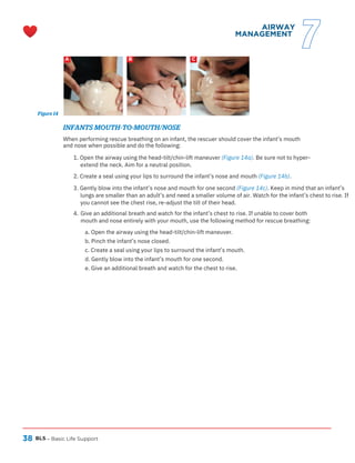 38 BLS
A B C
– Basic Life Support
Figure 14
AIRWAY
MANAGEMENT
7
INFANTS MOUTH-TO-MOUTH/NOSE
When performing rescue breathing on an infant, the rescuer should cover the infant’s mouth
and nose when possible and do the following:
1. Open the airway using the head-tilt/chin-lift maneuver (Figure 14a). Be sure not to hyper-
extend the neck. Aim for a neutral position.
2. Create a seal using your lips to surround the infant’s nose and mouth (Figure 14b).
Give an additional breath and watch for the infant’s chest to rise. If unable to cover both
mouth and nose entirely with your mouth, use the following method for rescue breathing:
4.
a. Open the airway using the head-tilt/chin-lift maneuver.
b. Pinch the infant’s nose closed.
c. Create a seal using your lips to surround the infant’s mouth.
d. Gently blow into the infant’s mouth for one second.
e. Give an additional breath and watch for the chest to rise.
3. Gently blow into the infant’s nose and mouth for one second (Figure 14c). Keep in mind that an infant’s
lungs are smaller than an adult’s and need a smaller volume of air. Watch for the infant’s chest to rise. If
you cannot see the chest rise, re-adjust the tilt of their head.
 