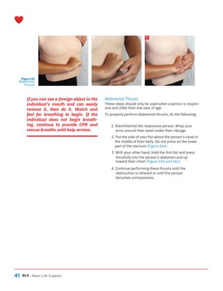 41 BLS
A B C
– Basic Life Support
Figure 16:
Abdominal
Thrusts
If you can see a foreign object in the
individual’s mouth and can easily
remove it, then do it. Watch and
feel for breathing to begin. If the
individual does not begin breath-
ing, continue to provide CPR and
rescue breaths until help arrives.
Abdominal Thrusts
These steps should only be used when a person is respon-
sive and older than one year of age.
To properly perform abdominal thrusts, do the following:
1. Stand behind the responsive person. Wrap your
arms around their waist under their ribcage.
3. With your other hand, hold the first fist and press
forcefully into the person’s abdomen and up
toward their chest (Figure 16b and 16c).
4. Continue performing these thrusts until the
obstruction is relieved or until the person
becomes unresponsive.
2. Put the side of your fist above the person’s navel in
the middle of their belly. Do not press on the lower
part of the sternum (Figure 16a).
 