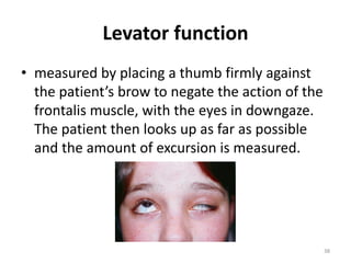Comprehensive Overview of Eyelid Disorders and Pharmacology in ...