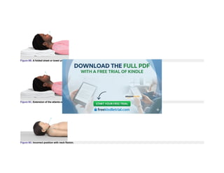 Figure 9B. A folded sheet or towel under the occiput.
Figure 9C. Extension of the atlanto-occipital joint.
Figure 9D. Incorrect position with neck flexion.
 