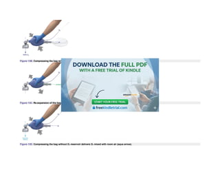 Figure 13B. Compressing the bag with O2 reservoir delivers 100% O2 to the patient (purple arrow).
Figure 13C. Re-expansion of the bag without an O2 reservoir.
Figure 13D. Compressing the bag without O2 reservoir delivers O2 mixed with room air (aqua arrow).
 