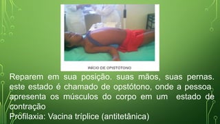 Reparem em sua posição. suas mãos, suas pernas.
este estado é chamado de opstótono, onde a pessoa
apresenta os músculos do corpo em um estado de
contração
Profilaxia: Vacina tríplice (antitetânica)
 