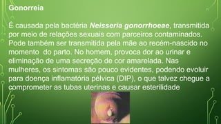 Gonorreia
É causada pela bactéria Neisseria gonorrhoeae, transmitida
por meio de relações sexuais com parceiros contaminados.
Pode também ser transmitida pela mãe ao recém-nascido no
momento do parto. No homem, provoca dor ao urinar e
eliminação de uma secreção de cor amarelada. Nas
mulheres, os sintomas são pouco evidentes, podendo evoluir
para doença inflamatória pélvica (DIP), o que talvez chegue a
comprometer as tubas uterinas e causar esterilidade
 