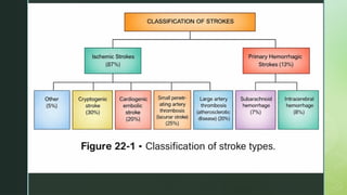 2026 Guidelines for Early Management of Acute Ischemic Stroke Patients ...