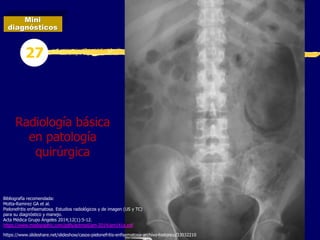 Mini
diagnósticos
27
Radiología básica
en patología
quirúrgica
Bibliografía recomendada:
Motta-Ramirez GA et al.
Pielonefritis enfisematosa. Estudios radiológicos y de imagen (US y TC)
para su diagnóstico y manejo.
Acta Médica Grupo Ángeles 2014;12(1):5-12.
https://www.medigraphic.com/pdfs/actmed/am-2014/am141a.pdf
https://www.slideshare.net/slideshow/casos-pielonefritis-enfisematosa-archivo-historico/33032210
 