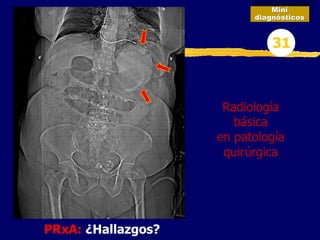 PRxA: ¿Hallazgos?
Mini
diagnósticos
31
Radiología
básica
en patología
quirúrgica
 