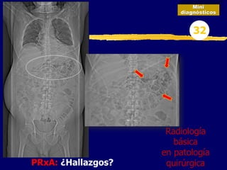 PRxA: ¿Hallazgos?
Mini
diagnósticos
32
Radiología
básica
en patología
quirúrgica
 