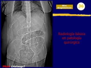Mini
diagnósticos 36
PRxA: ¿Hallazgo?
Radiología básica
en patología
quirúrgica
 