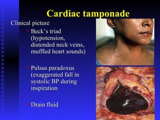 Anatomy of the Heart-and-Pericardium ppt .pdf