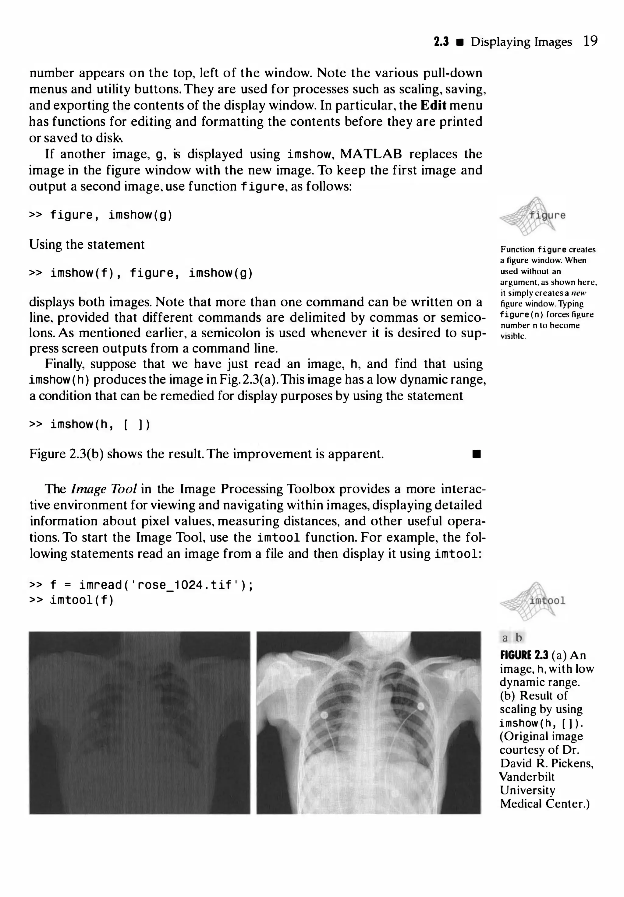 2.3 • Displaying Images 19
number appears on the top, left of the window. Note the various pull-down
menus and utility buttons.They are used for processes such as scaling, saving,
and exporting the contents of the display window. In particular, the Edit menu
has functions for editing and formatting the contents before they are printed
or saved to disk·.
If another image, g, is displayed using imshow, MATLAB replaces the
image in the figure window with the new image. To keep the first image and
output a second image, use function figure, as follows:
>> figure , imshow ( g )
Using the statement
>> imshow ( f ) , figure , imshow ( g )
displays both images. Note that more than one command can be written on a
line. provided that different commands are delimited by commas or semico­
lons. As mentioned earlier, a semicolon is used whenever it is desired to sup­
press screen outputs from a command line.
Finally, suppose that we have just read an image, h, and find that using
imshow(h) produces the image in Fig.2.3(a).This image has a low dynamic range,
a condition that can be remedied for display purposes by using the statement
>> imshow ( h , [ ] )
Figure 2.3(b) shows the result. The improvement is apparent. •
The Image Tool in the Image Processing Toolbox provides a more interac­
tive environment for viewing and navigating within images, displaying detailed
information about pixel values, measuring distances, and other useful opera­
tions. To start the Image Tool, use the imtool function. For example, the fol­
lowing statements read an image from a file and then display it using imtool:
>> f = imread ( ' rose_1 024 . tif ' ) ;
» imtool ( f )
Function figure creates
a figure window. When
used without an
argument, as shown here.
it simply creates a new
figure window. Typing
figure ( n ) forces figure
number n to become
visible.
�tool
a b
FIGURE 2.3 (a) An
image, h, with low
dynamic range.
(b) Result of
scaling by using
imshow ( h , [ I ) .
(Original image
courtesy of Dr.
David R. Pickens,
Vanderbilt
University
Medical Center.)
 