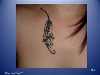 MLD
Where’s yours ?
 