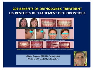 204-BENEFITS OF ORTHODONTIC TREATMENT
LES BENEFICES DU TRAITEMENT ORTHODONTIQUE
Olivier Oussama SANDID- Orthodontist,
D.C.D., D.U.O, C.E.S.B.B, C.E.S.O.D.F ,.
 