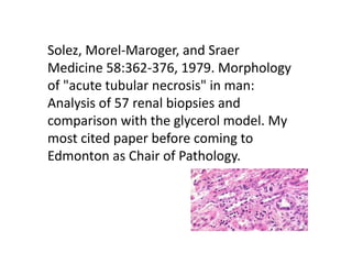Solez, Morel-Maroger, and Sraer
Medicine 58:362-376, 1979. Morphology
of "acute tubular necrosis" in man:
Analysis of 57 r...