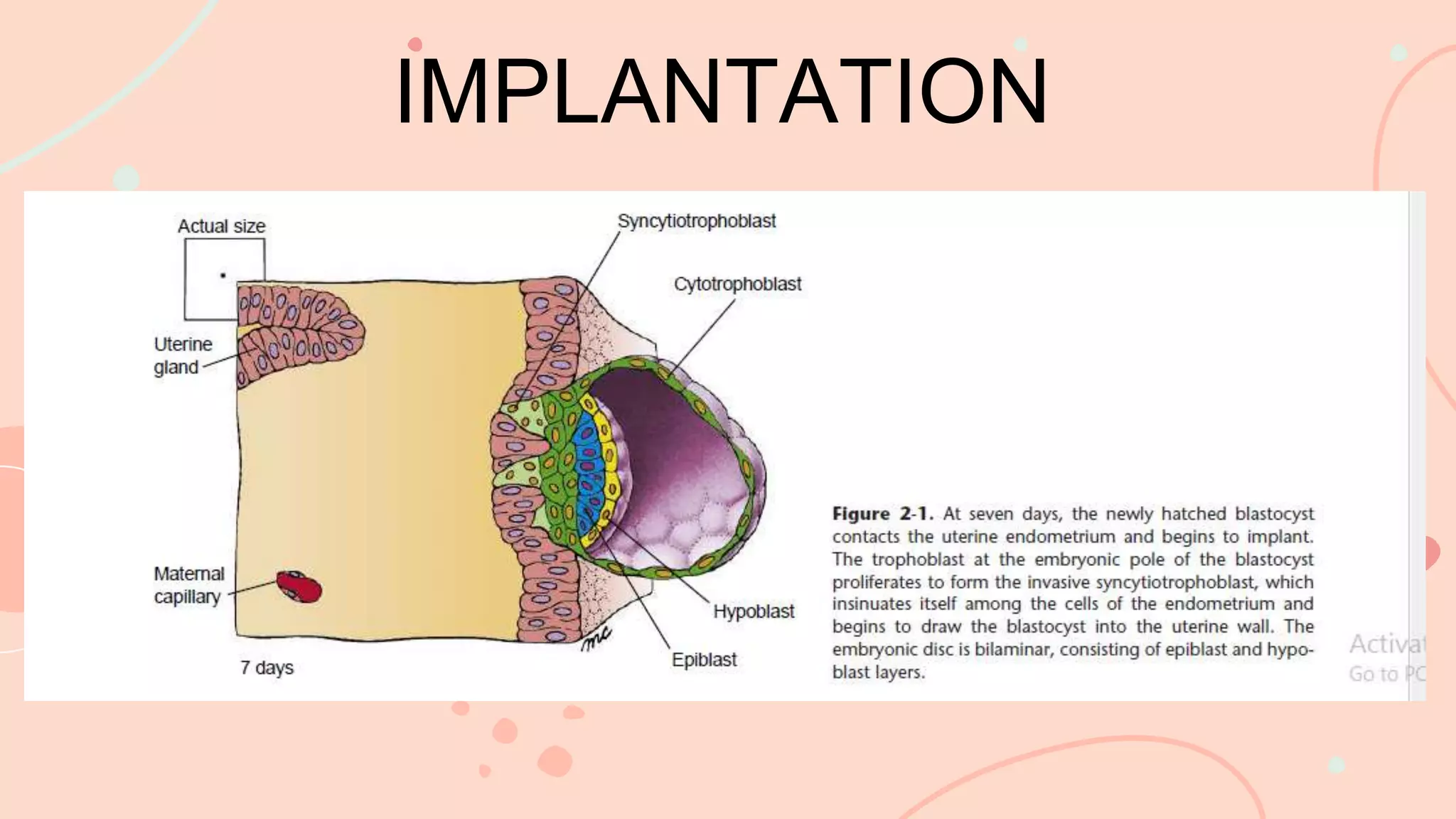 IMPLANTATION