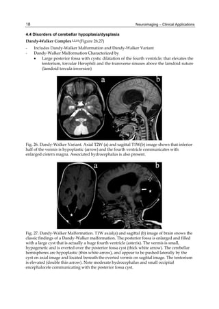 Neuroimaging Clinical Applications P Bright | PDF